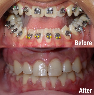 before-and-after-1